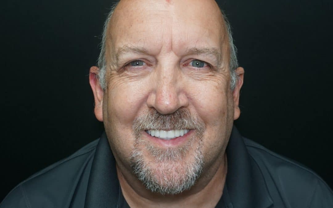 RW smiling bright after all on x dental implants with Dr. Seale in Rincon GA