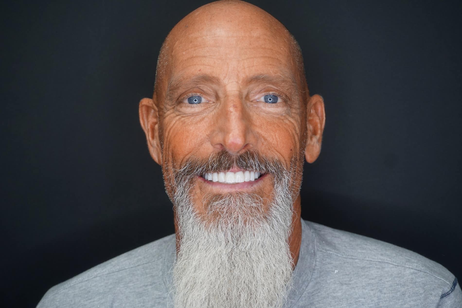John with a brilliant new smile after full mouth restoration with iHeart Dental