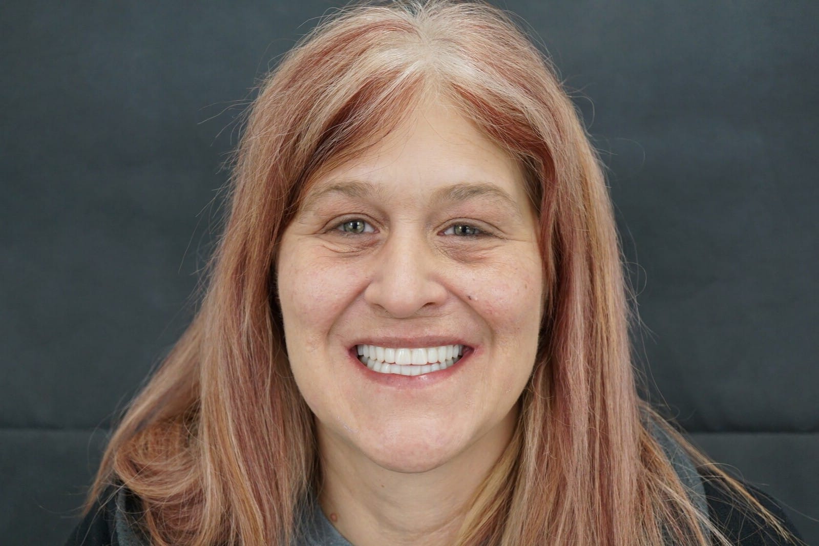 Wendy's try in dentures at iHeart Dental in Rincon GA