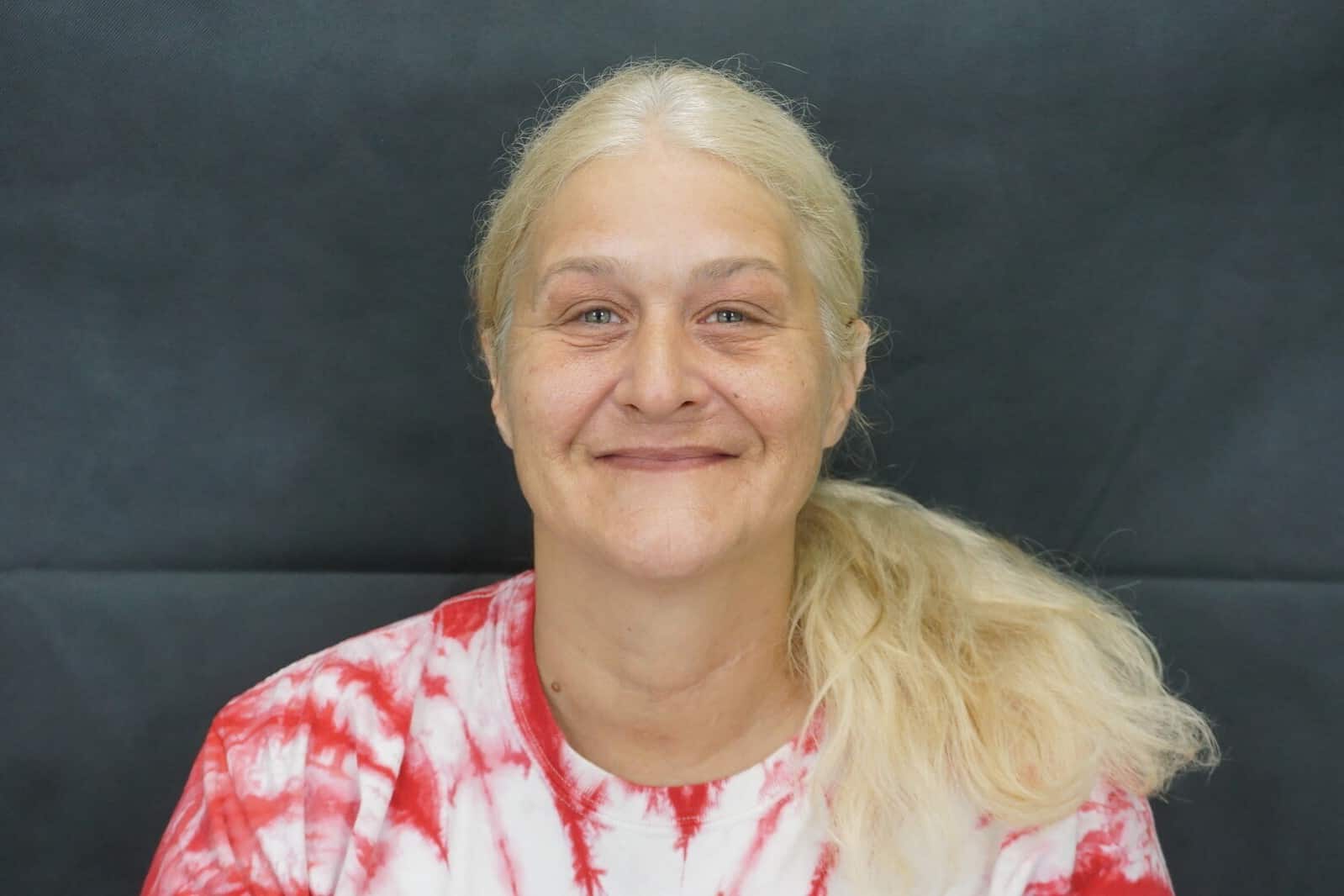 Wendy's before smile tranformation photo at Iheart Dental in Rincon GA